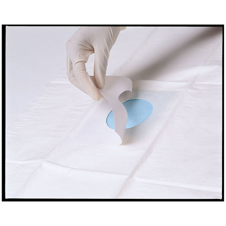 Busse Towels/Drapes - Drapes with Fenestration - Sterile - Adhesive Patch