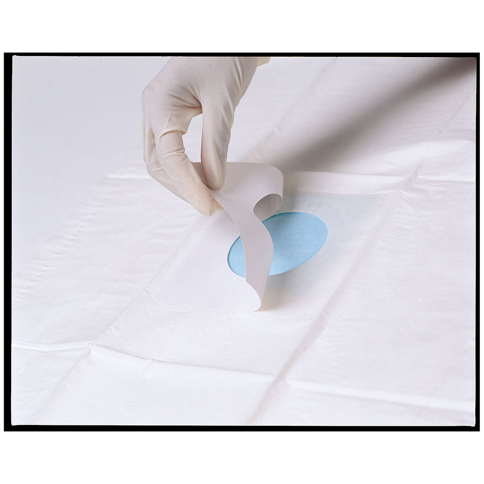 Busse Towels/Drapes - Drapes with Fenestration - Sterile - Adhesive Patch