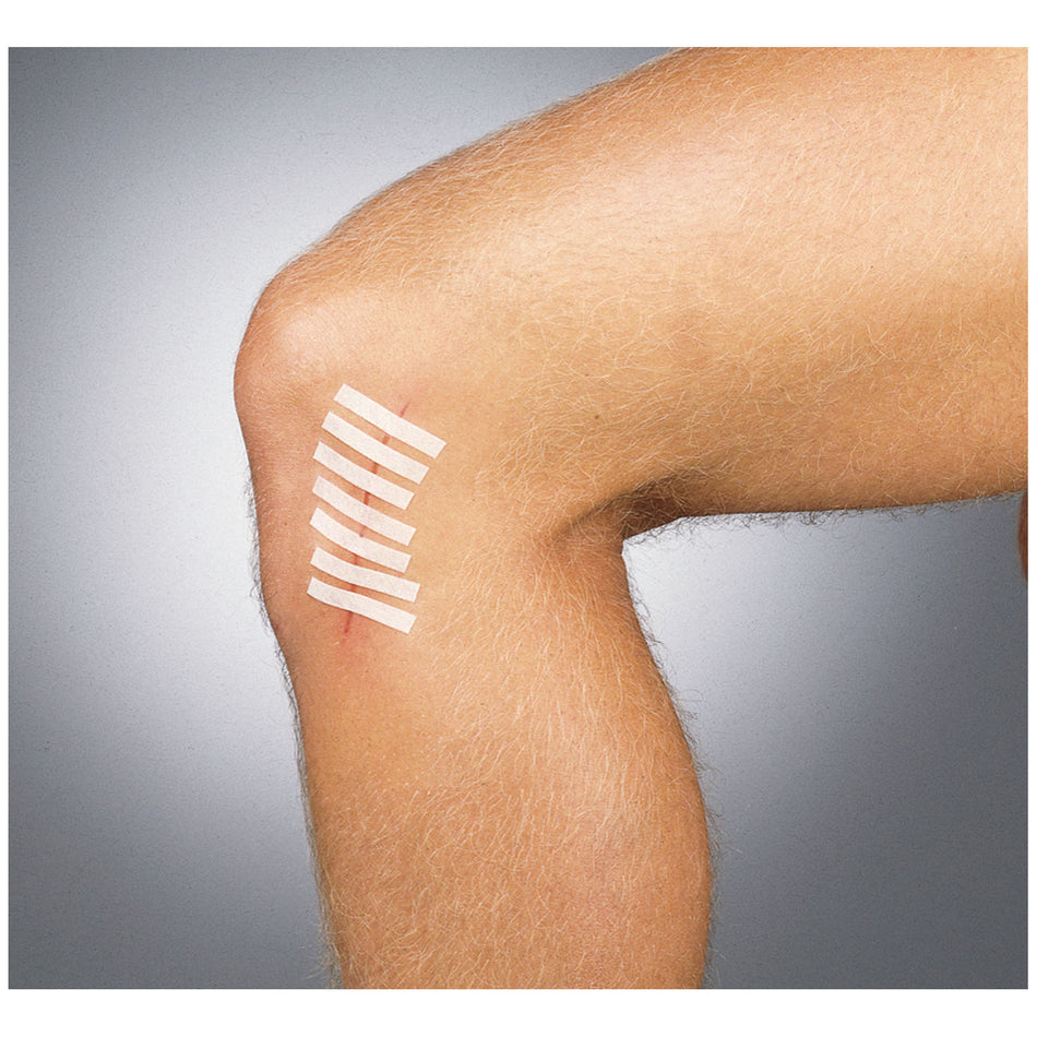 Gentell Suture Strip Wound Closure Strips - Pouch