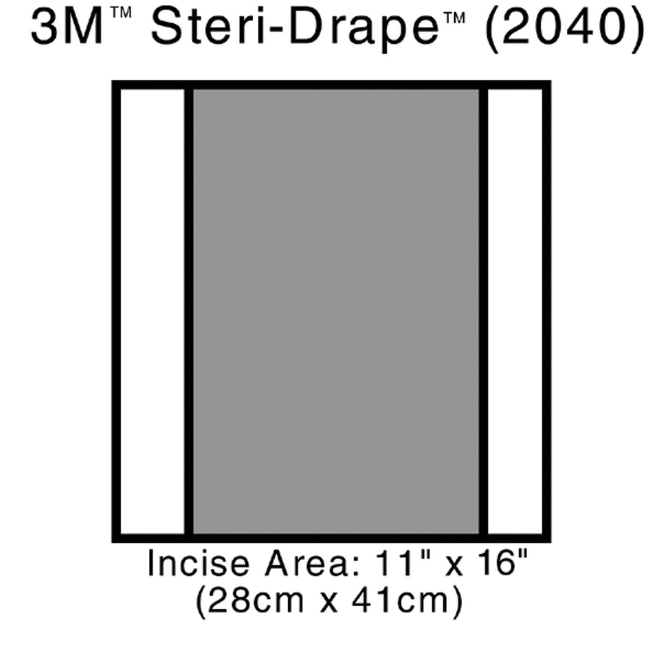 Solventum Steri-Drapetm 2 Incise Drapes