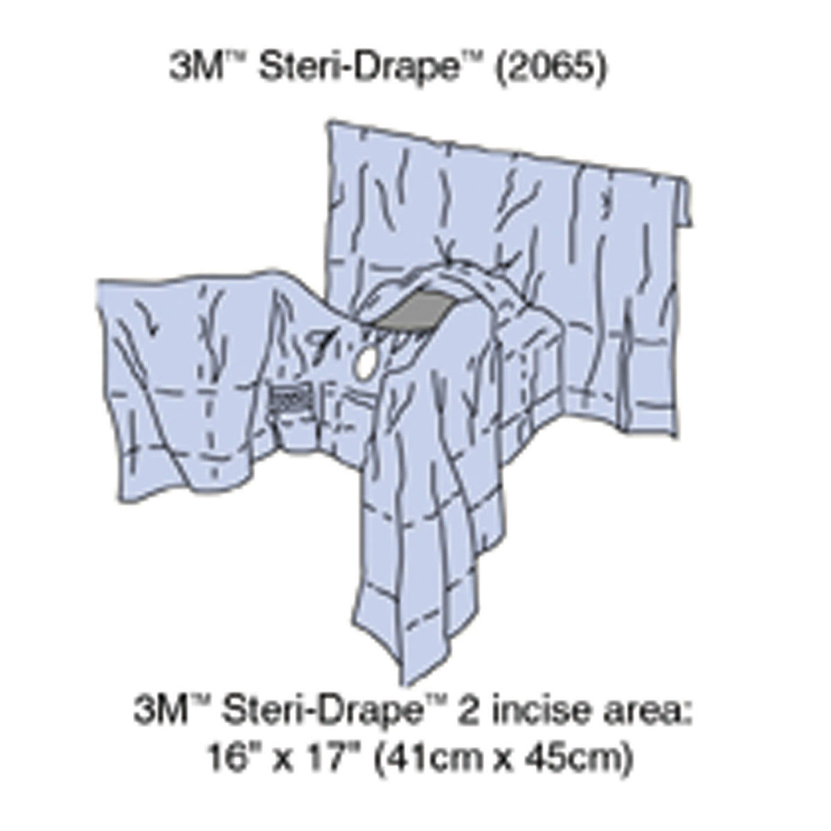Solventum General Surgery Drapes - Abdominal Perineal