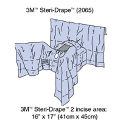 Solventum General Surgery Drapes - Abdominal Perineal
